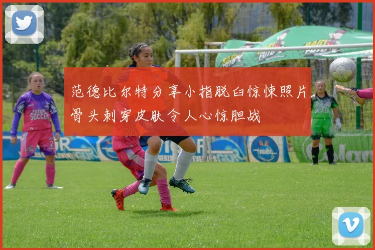 范德比尔特分享小指脱臼惊悚照片骨头刺穿皮肤令人心惊胆战